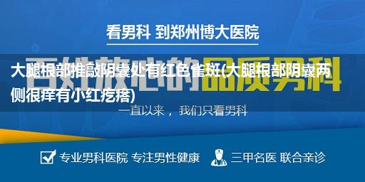 大腿根部推敲阴囊处有红色雀斑(大腿根部阴囊两侧很痒有小红疙瘩)